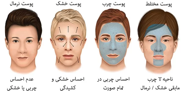 تفاوت پوست چرب و جوش‌دار